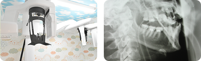 Our clinic is fully equipped with dental CT/cephalogram equipment