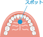 正しい舌の位置