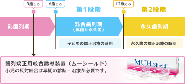 ムーシールド　小児の反対咬合は早期の診断・治療が必要です。